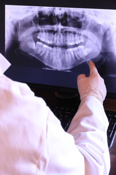 Best Root Canal Emergency Dentist  in New Lenox, IL